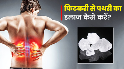 फिटकरी से पथरी का इलाज कैसे करें? जानें 3 तरीके