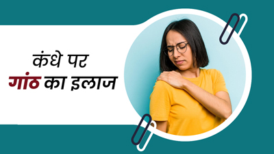कंधे पर गांठ होने पर क्‍या करें? डॉक्‍टर से जानें इलाज