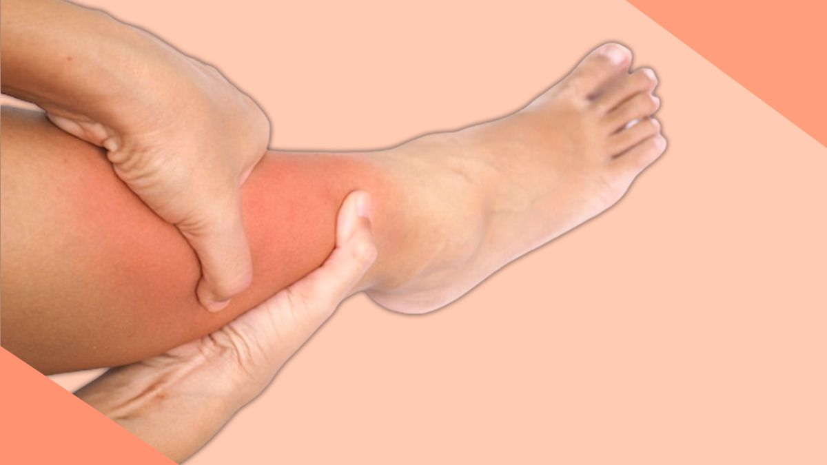 swelling in leg treatment 