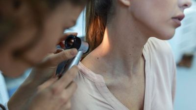 स्किन कैंसर के कितने स्टेज होते हैं? जानें डॉक्टर से बचाव के टिप्स