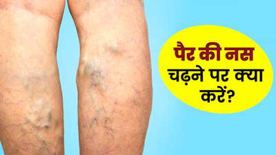 पैर में नस पर नस चढ़ जाए, तो राहत पाने के लिए अपनाएं ये 5 उपाय