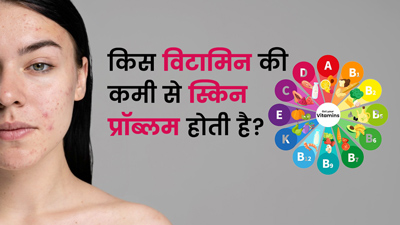 किस विटामिन की कमी से Skin Dull हो जाती है? जानें बचाव के उपाय