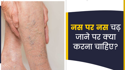 Veins Cramps: नस पर नस चढ़ जाने पर क्या करना चाहिए?