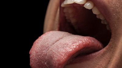 गंदी जीभ के कारण कौन-कौन सी बीमारियां हो सकती हैं?