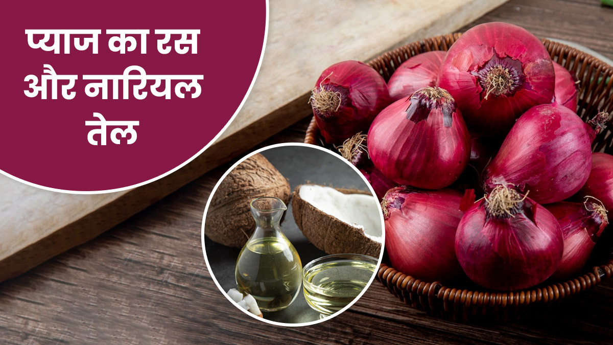 बालों के लिए प्याज का रस और नारियल तेल के फायदे | Onion Juice and Coconut  Oil for Hair Benefits in Hindi