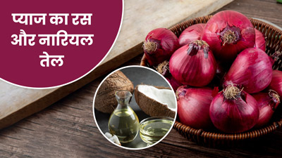 बालों में लगाएं प्याज का रस और नारियल तेल, डैंड्रफ से मिलेगा छुटकारा