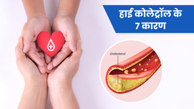 High Cholesterol के पीछे हो सकते हैं ये 7 कारण, जानें कम करने उपाय