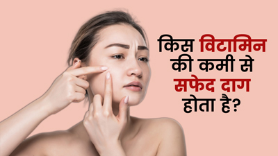 किस विटामिन की कमी से स्किन पर सफेद दाग होते हैं, जानें कैसे करें पूर्ति