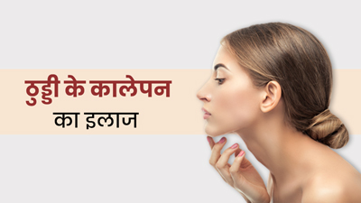 ठुड्डी का कालापन दूर करने के 5 घरेलू उपाय