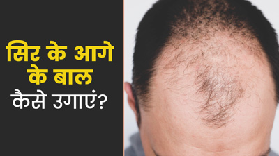 झड़ गए हैं सिर के आगे के बाल? दोबारा उगाने में मदद करेंगे ये 5 उपाय