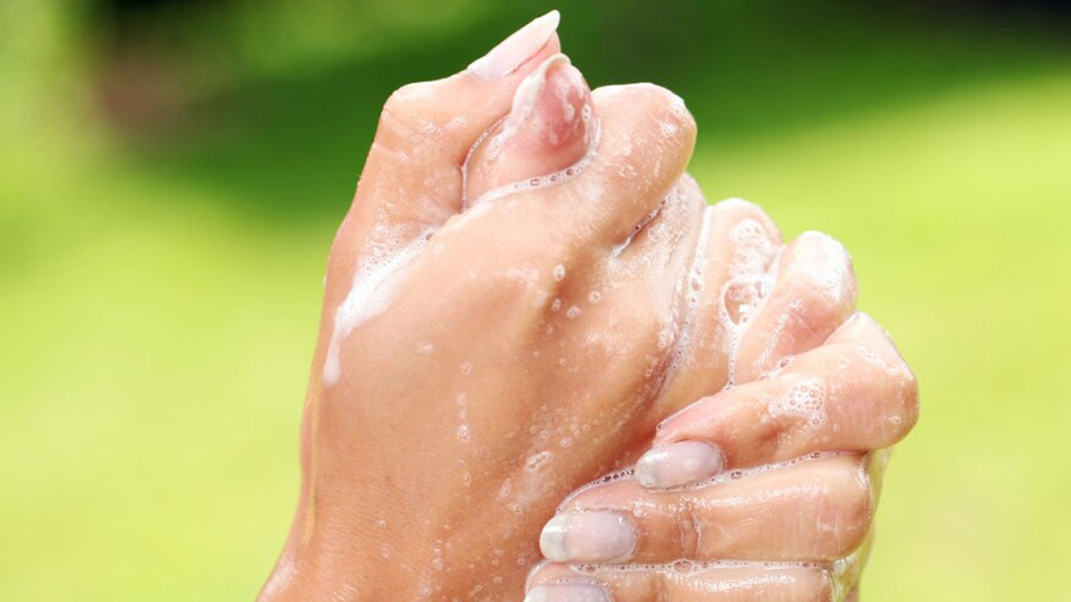 things to keep in mind in eczema disease in hindi