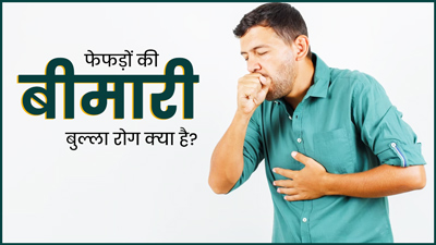 बुल्‍ला रोग क्‍या है, ज‍िसमें गुब्‍बारेनुमा होकर खोखले हो जाते हैं फेफड़े? जानें लक्षण, कारण और इलाज
