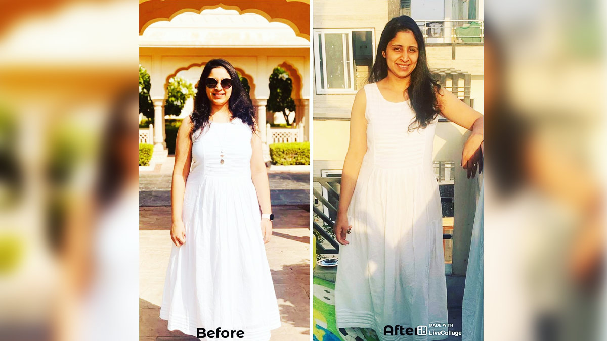 weight-loss-fat-loss-journey-Aakriti-Kalra-t