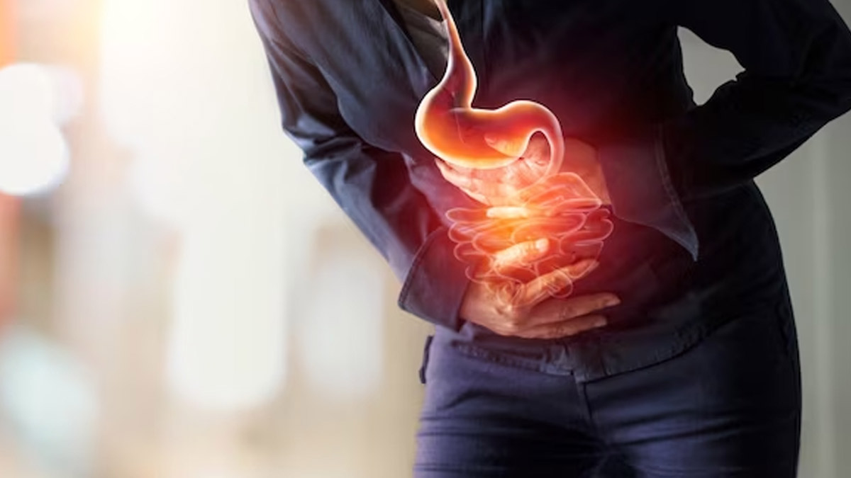 Causes Of GERD Disease in hindi