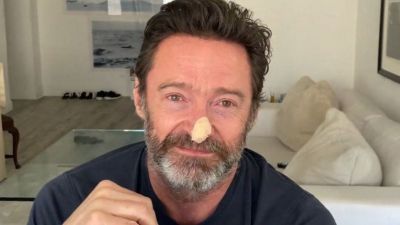 डेडपूल स्टार Hugh Jackman को हुआ स्किन कैंसर, धूप में रहने वाले लोगों को दी ये सलाह