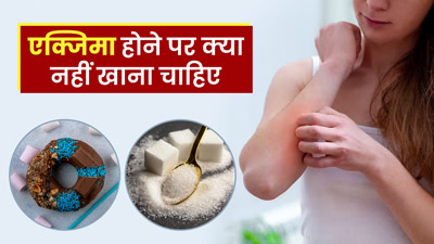 एक्जिमा होने पर क्या नहीं खाना चाहिए, जानिए एक्सपर्ट से
