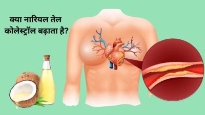क्या नारियल तेल कोलेस्ट्रॉल बढ़ाता है? जानें डायटीशियन से