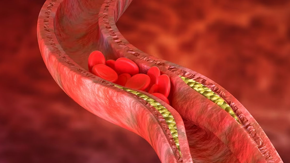 Healthy blood vessels