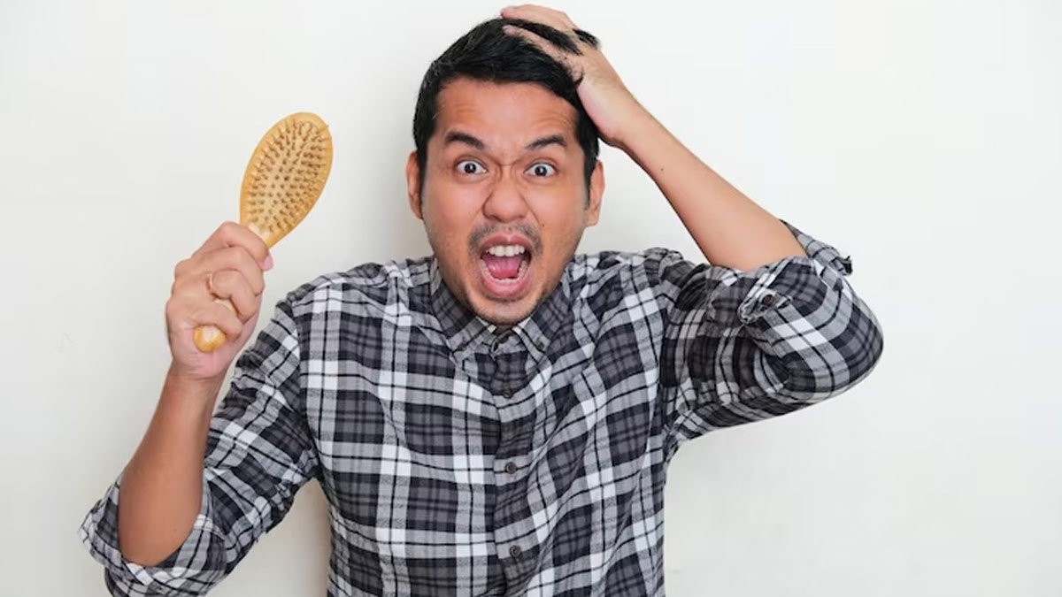Hair Loss In Men