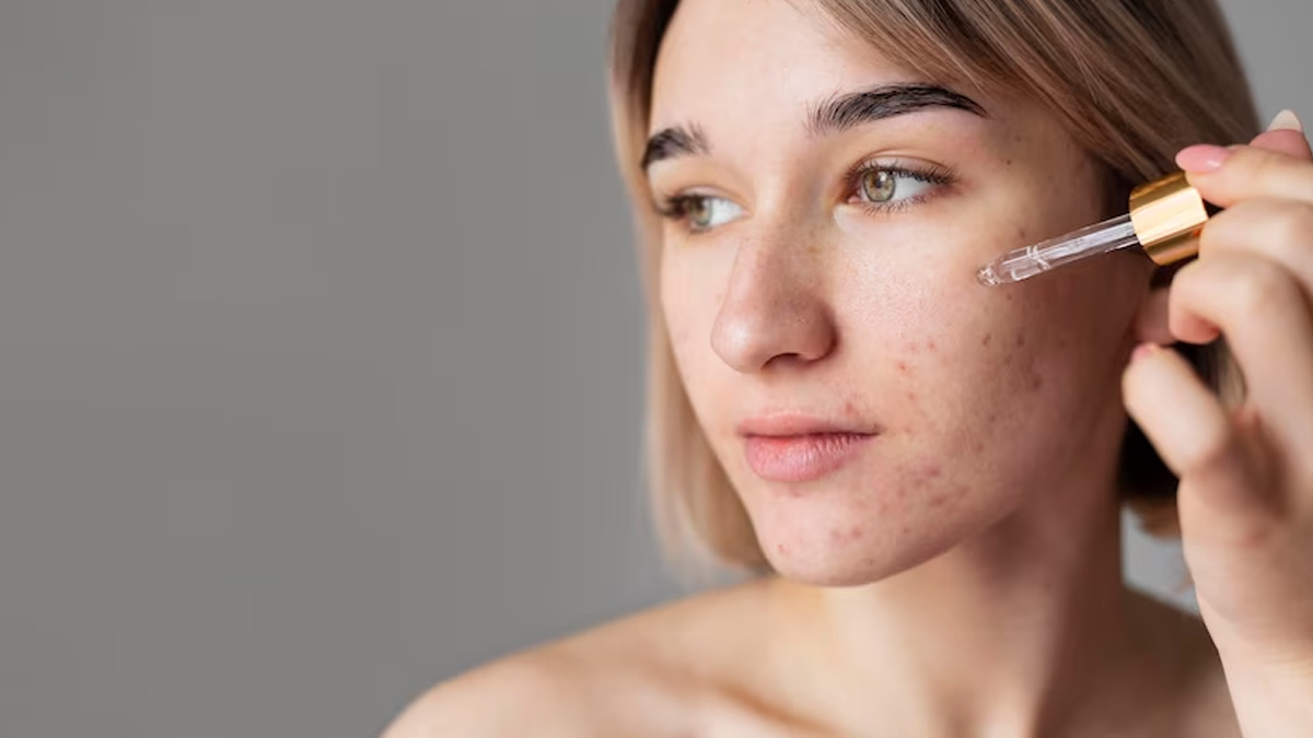 Retinol Mistakes You Should Never Make