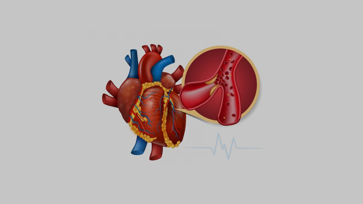 Does Coconut Water Increase Cholesterol