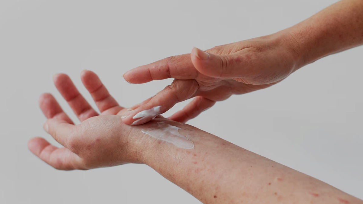 palm rash causes and treatment in hindi