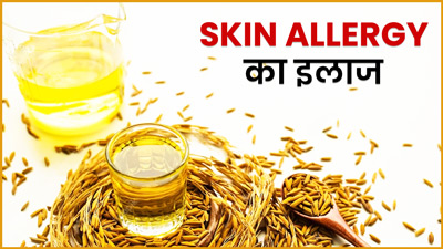 स्‍क‍िन एलर्जी दूर करता है राइस ब्रान ऑयल, जानें इस्‍तेमाल का तरीका  