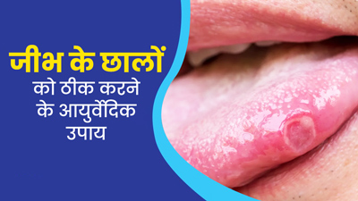जीभ के छालों से छुटकारा पाने के लिए आजमाएं ये 5 आयुर्वेदिक उपाय, जल्द मिलेगी दर्द से राहत