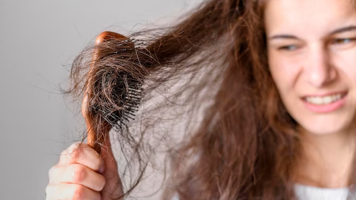 Hair Fall: Natural Ways To Deal With It    