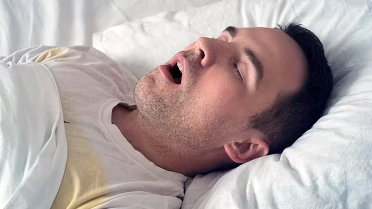 Obstructive Sleep Apnoea: Doctor Explains Its Treatment