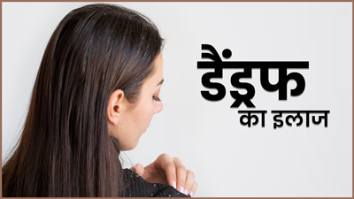 बालों में डैंड्रफ की समस्या दूर करेगी अलसी, जानें इस्तेमाल का तरीका