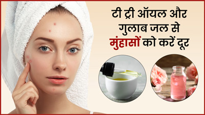 मुंहासों को दूर करने के लिए चेहरे पर लगाएं टी ट्री ऑयल और गुलाब जल, जानें इस्तेमाल का तरीका