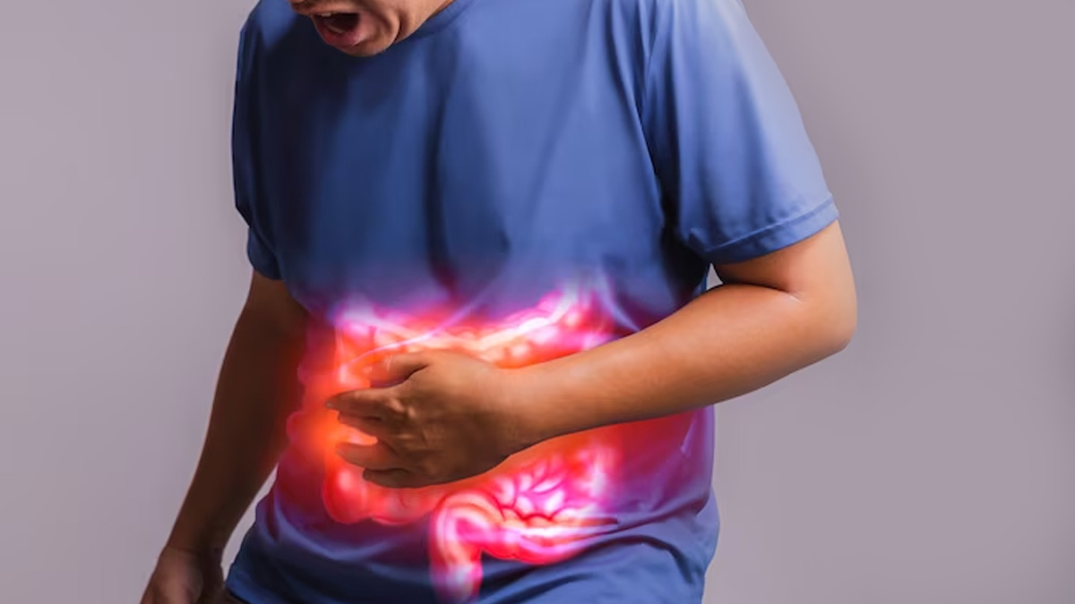 GERD Foods That Trigger Acid Reflux and Heartburn OnlyMyHealth