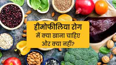 World Hemophilia Day 2023: हीमोफीलिया रोग में क्या खाना चाहिए और क्या नहीं? जानें एक्सपर्ट से
