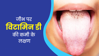 विटामिन डी की कमी होने पर जीभ पर दिखते हैं ये 4 लक्षण, न करें नजरअंदाज