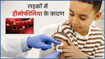 World Hemophilia Day 2023: लड़कों में ही ज्यादा क्यों देखने को मिलते हैं हीमोफीलिया के मामले? 