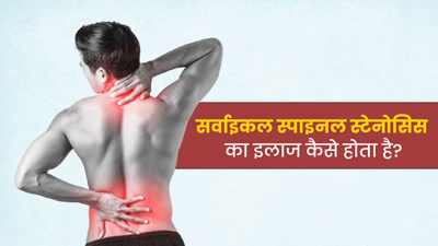 सर्वाइकल स्पाइनल स्टेनोसिस क्या है और क्यों होता है? डॉक्टर से जानें इस बीमारी के बारे में