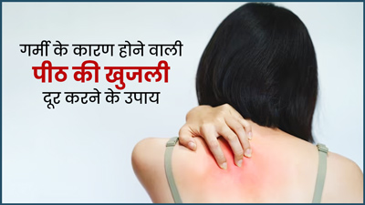 गर्मी के कारण होने वाली पीठ की खुजली दूर करने के घरेलू उपाय