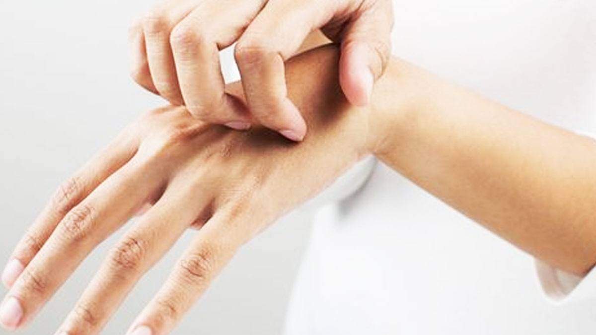 itchy hand