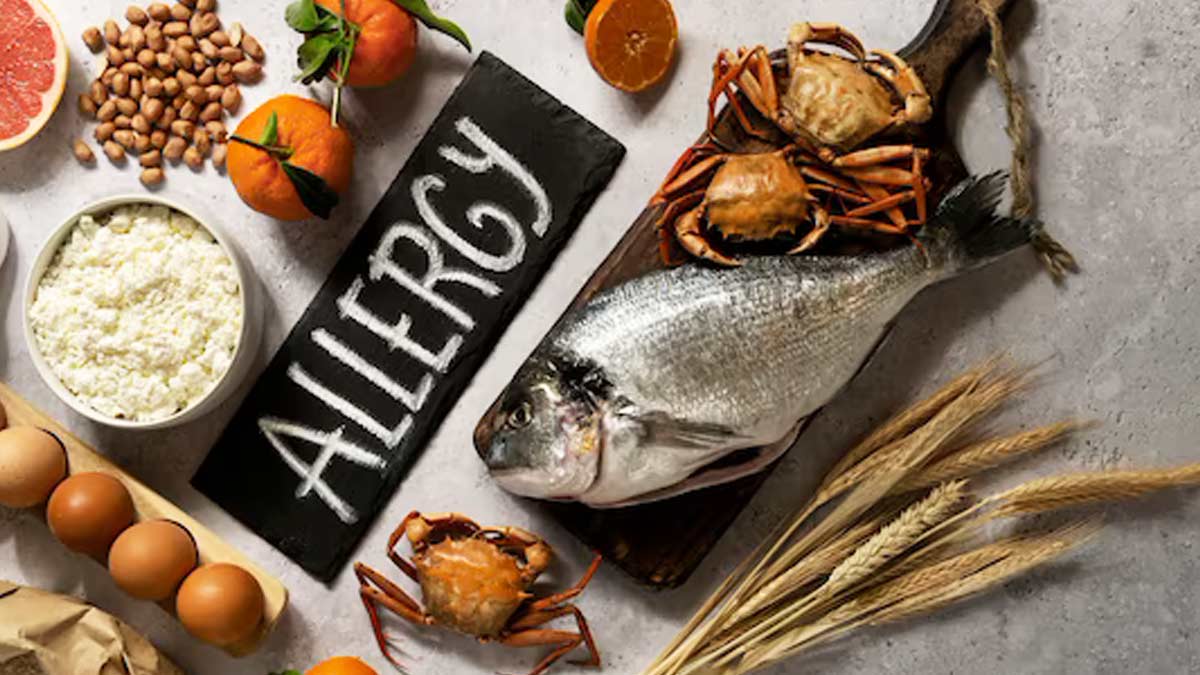 Allergy: Here Are 7 Food Items That Can Trigger It 