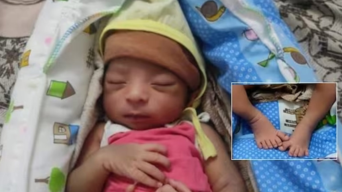 तेलंगाना: हाथ-पैर में 12-12 उंगलियों के साथ पैदा हुआ अनोखा बच्चा, डॉक्टर्स हुए हैरान