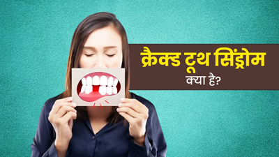 आधे टूटे दांत के कारण आपको हो सकती हैं कई गंभीर परेशानियां, जानें इसका कारण और इलाज