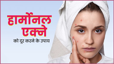 हार्मोनल एक्ने के क्या कारण होते हैं? जानें इसे दूर करने के उपाय 