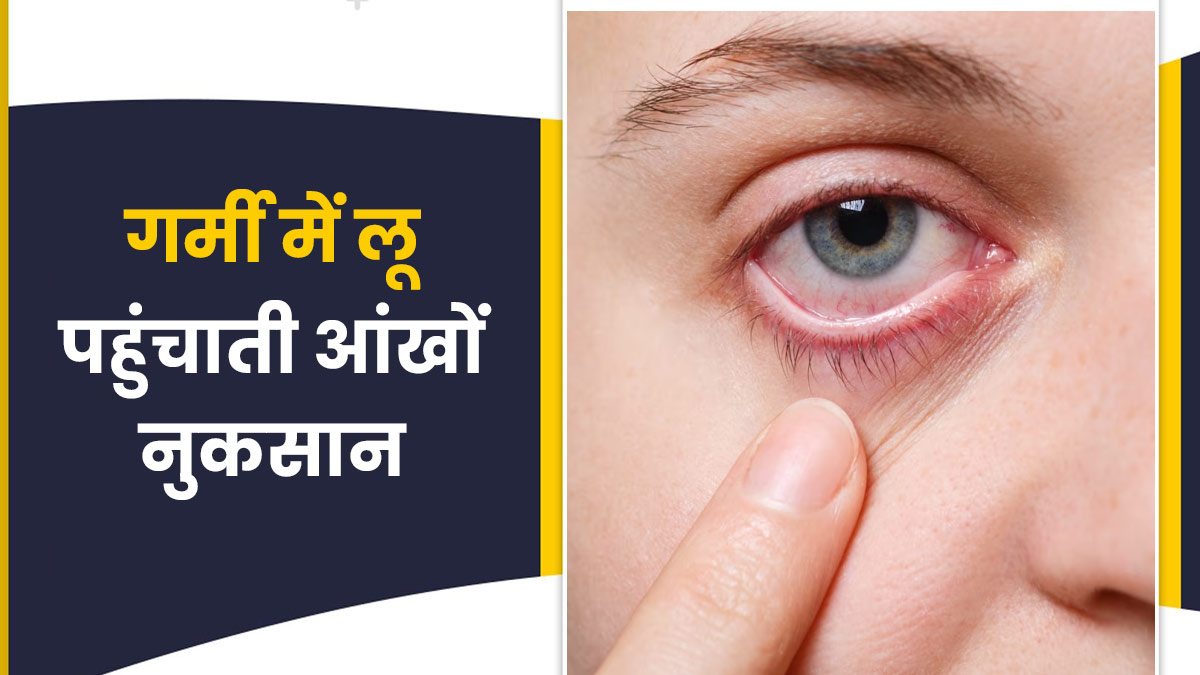 गर्म हवा (लू) पहुंचा सकती है आंखों को नुकसान, डॉक्टर से जानें गर्मियों में आंखों को स्वस्थ रखने के उपाय