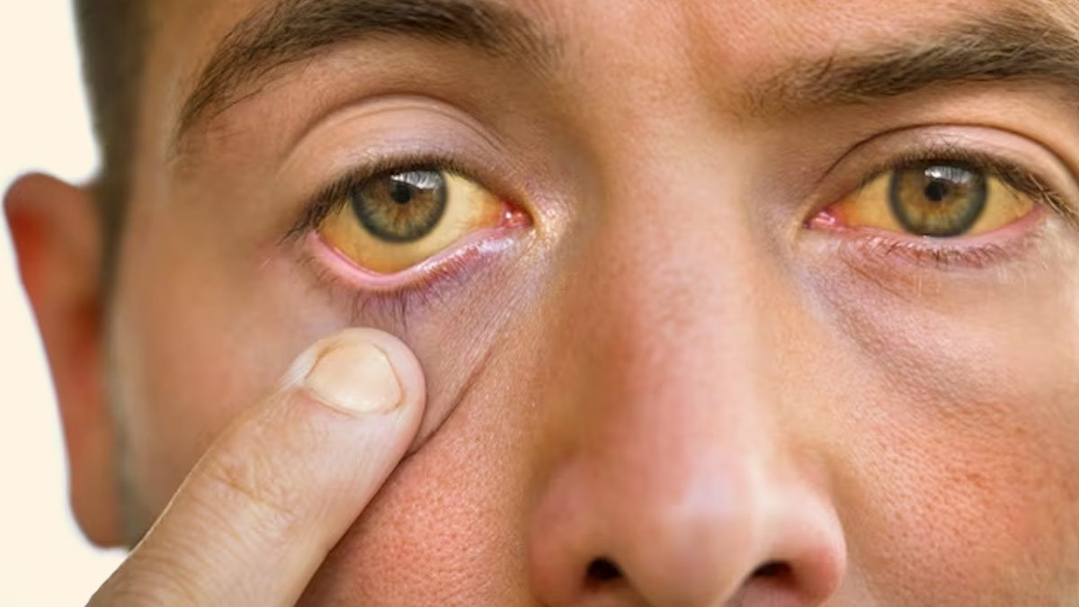 How To Protect Eyes From Heat Waves