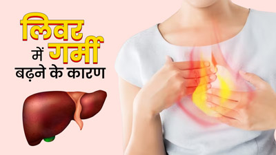 लिवर में गर्मी क्यों बढ़ती है? डॉक्टर से जानें कारण और गर्मी कम करने के उपाय