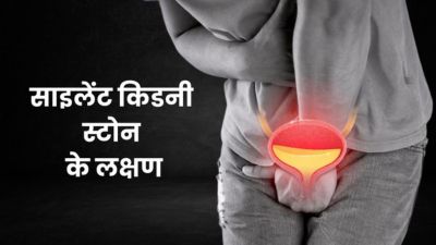 साइलेंट किडनी स्टोन की वजह से डैमेज हो सकती है आपकी किडनी, जानें इसके लक्षण और बचाव