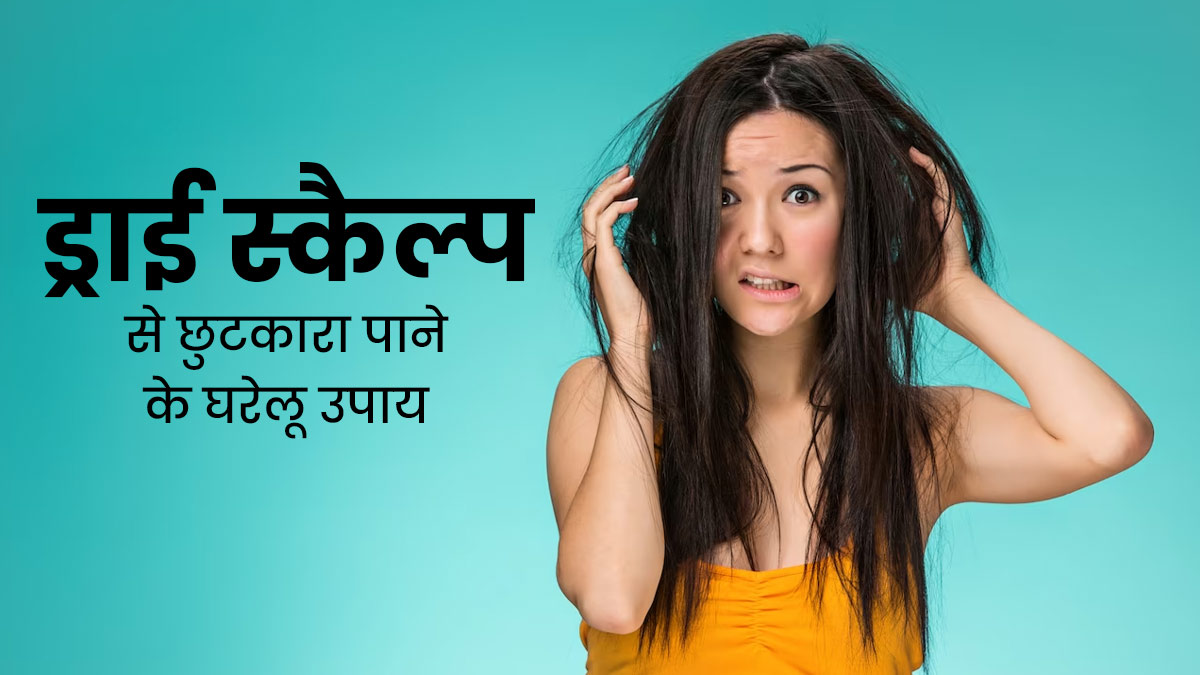 ड्राई स्कैल्प की समस्या से छुटकारा पाने के लिए आजमाएं ये 5 घरेलू उपाय
