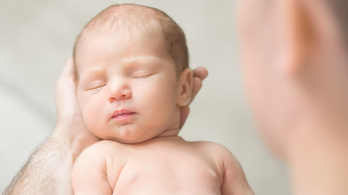 birthmarks in infants