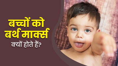 बच्चों के शरीर में बर्थ मार्क्स क्यों होते हैं? जानें कब होती है इलाज की जरूरत 